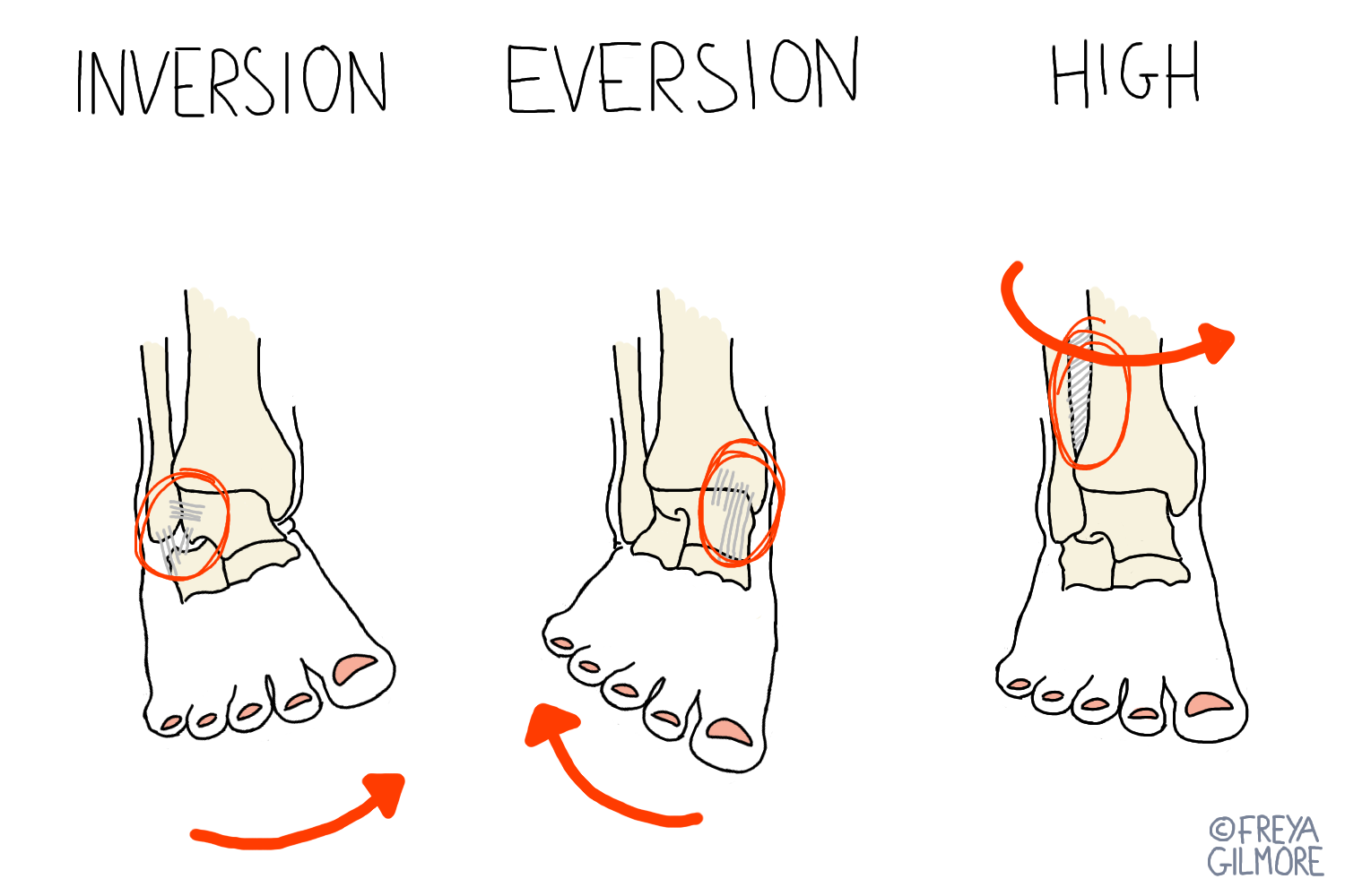 Sports Injuries: ankle sprains